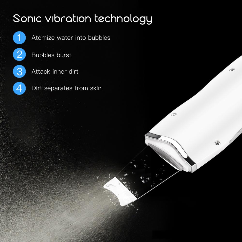 Professional  Ultrasonic Skin Spatula